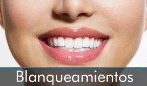 blanqueamiento-dental-clinica-dental-almansa