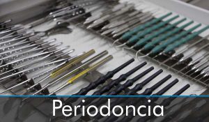 periodoncia-clinica-dental-almansa