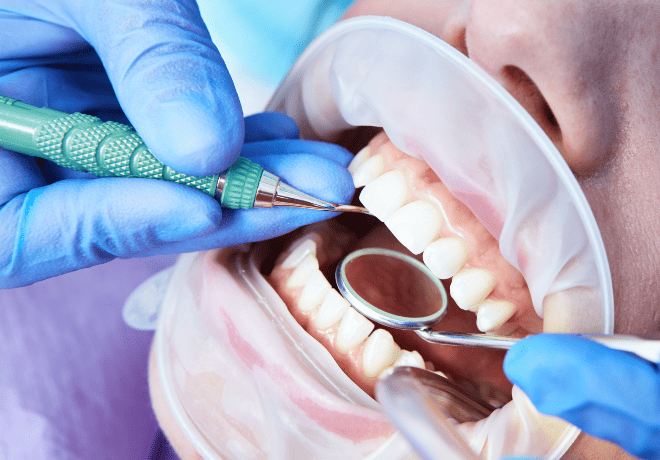 periodoncia