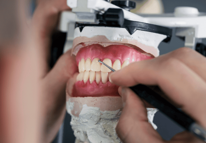 protesis dental